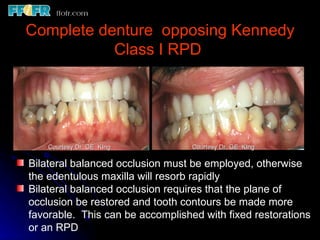 10.maxillo mandibular records | PPT