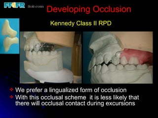 K2 Rpd Maxilaly 10.maxillo mandibular records | PPT