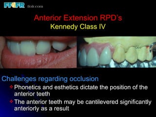 10.maxillo mandibular records | PPT