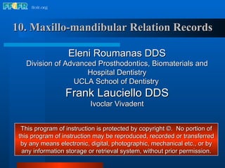 10. Maxillo-mandibular Relation Records Eleni Roumanas DDS Division of Advanced Prosthodontics, Biomaterials and Hospital Dentistry UCLA School of Dentistry   Frank Lauciello DDS Ivoclar Vivadent This program of instruction is protected by copyright ©.  No portion of this program of instruction may be reproduced, recorded or transferred by any means electronic, digital, photographic, mechanical etc., or by any information storage or retrieval system, without prior permission. 