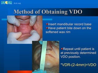 10.maxillomandibular relation records | PPT