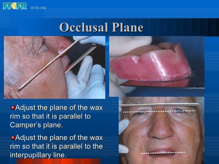 10.maxillomandibular relation records