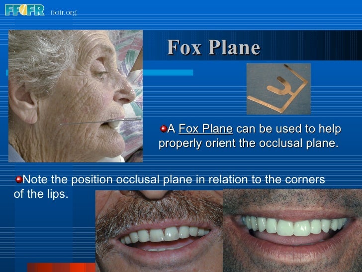 10.maxillomandibular relation records