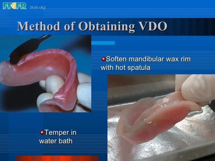 10.maxillomandibular relation records