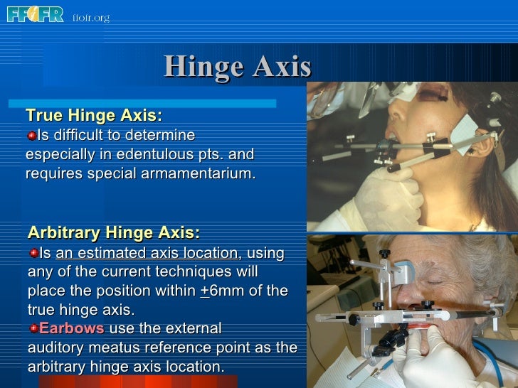10.maxillomandibular relation records