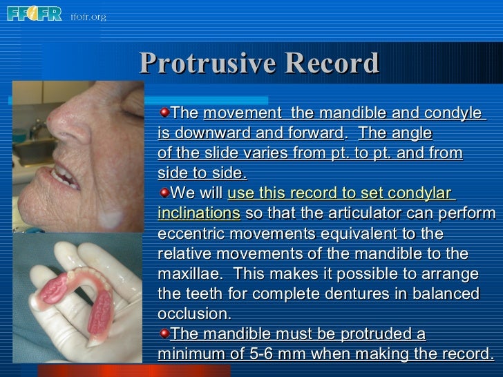 10.maxillomandibular relation records