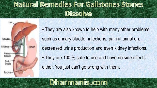 Natural Remedies To Help Pass Kidney Stones Natural Remedies To Help Pass Kidney Stones