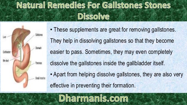 Natural Remedies For Gallstones And Kidney Stones Natural Remedies For Gallstones And Kidney Stones