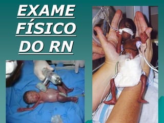 EXAME
FÍSICO
DO RN
 