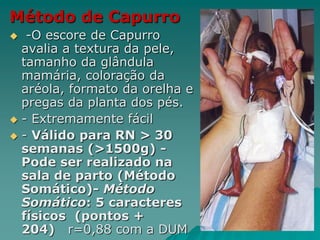 Método de Capurro
 -O escore de Capurro
avalia a textura da pele,
tamanho da glândula
mamária, coloração da
aréola, formato da orelha e
pregas da planta dos pés.
 - Extremamente fácil
 - Válido para RN > 30
semanas (>1500g) -
Pode ser realizado na
sala de parto (Método
Somático)- Método
Somático: 5 caracteres
físicos (pontos +
204) r=0,88 com a DUM
 