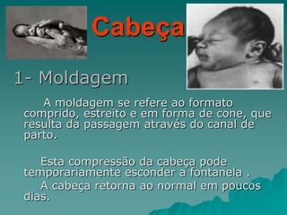 Cabeça
1- Moldagem
A moldagem se refere ao formato
comprido, estreito e em forma de cone, que
resulta da passagem através do canal de
parto.
Esta compressão da cabeça pode
temporariamente esconder a fontanela .
A cabeça retorna ao normal em poucos
dias.
 