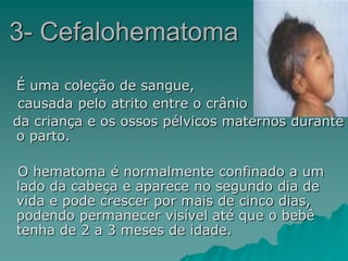 É uma coleção de sangue,
causada pelo atrito entre o crânio
da criança e os ossos pélvicos maternos durante
o parto.
O hematoma é normalmente confinado a um
lado da cabeça e aparece no segundo dia de
vida e pode crescer por mais de cinco dias,
podendo permanecer visível até que o bebê
tenha de 2 a 3 meses de idade.
3- Cefalohematoma
 