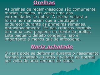 Orelhas
As orelhas de recém-nascidos são comumente
macias e moles. Às vezes uma das
extremidades se dobra. A orelha voltará a
forma normal assim que a cartilagem
endurecer durante as primeiras semanas.
Aproximadamente 1% das crianças normais
tem uma cova pequena na frente da orelha.
Este pequeno defeito congênito não é
importante a menos que se infeccione.
Nariz achatado
O nariz pode se deformar durante o nascimento
ficando achatado ou torto e voltará ao normal
por volta de uma semana de idade.
 