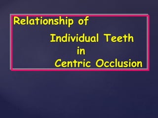 Relationship of
Individual Teeth
in
Centric Occlusion
 