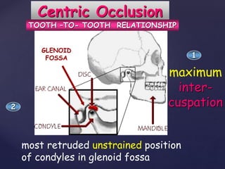 Centric Occlusion
maximum
inter-
cuspation
most retruded unstrained position
of condyles in glenoid fossa
GLENOID
FOSSA
TOOTH –TO- TOOTH RELATIONSHIP
1
2
 