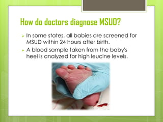 How do doctors diagnose MSUD?
 In some states, all babies are screened for
  MSUD within 24 hours after birth.
 A blood sample taken from the baby's
  heel is analyzed for high leucine levels.
 