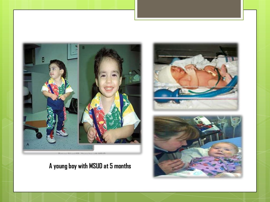 10. pangan maple syrup disease