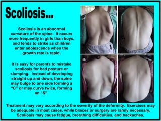 Scoliosis is an abnormal
curvature of the spine. It occurs
more frequently in girls than boys,
and tends to strike as children
enter adolescence when the
growth rate is rapid.
It is easy for parents to mistake
scoliosis for bad posture or
slumping. Instead of developing
straight up and down, the spine
may bulge to one side forming a
“C” or may curve twice, forming
an “S”.
Treatment may vary according to the severity of the deformity. Exercises may
be adequate in most cases, while braces or surgery are rarely necessary.
Scoliosis may cause fatigue, breathing difficulties, and backaches.
 