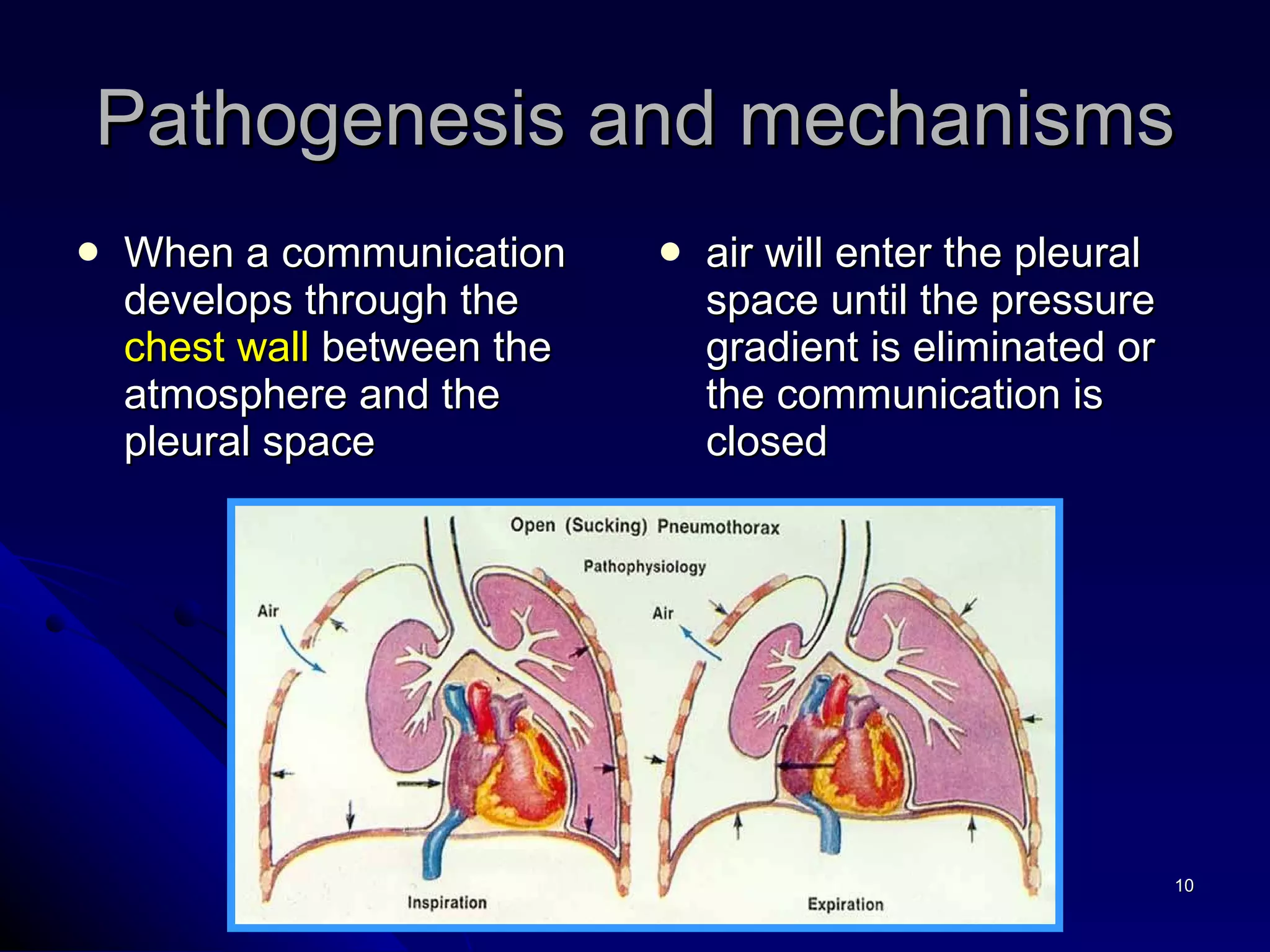 Pathogenesis and mechanisms When a communication develops through the  chest wall  between the atmosphere and the pleural space  air will enter the pleural space until the pressure gradient is eliminated or the communication is closed 