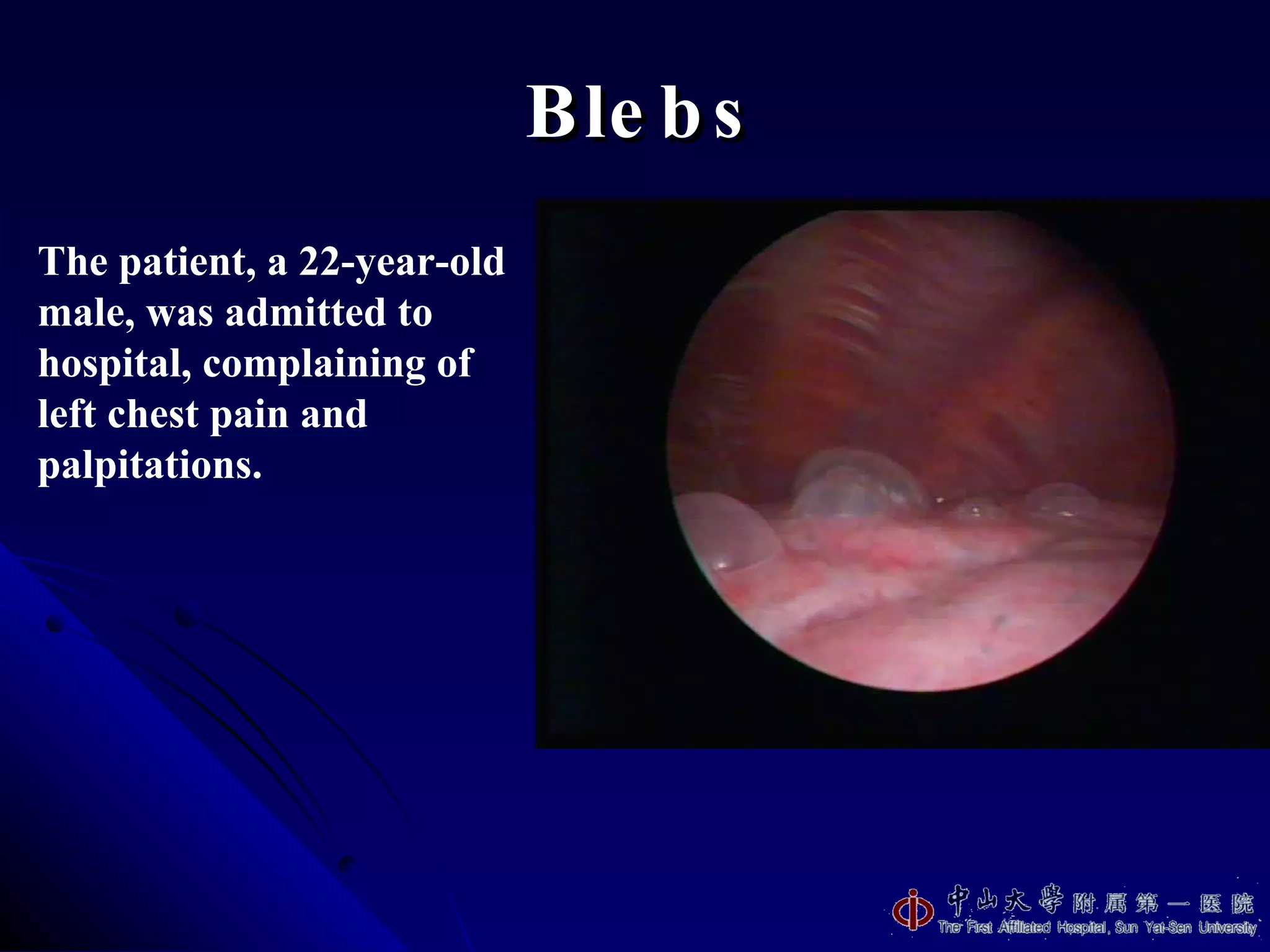 Blebs The patient, a 22-year-old male, was admitted to hospital, complaining of left chest pain and palpitations. 