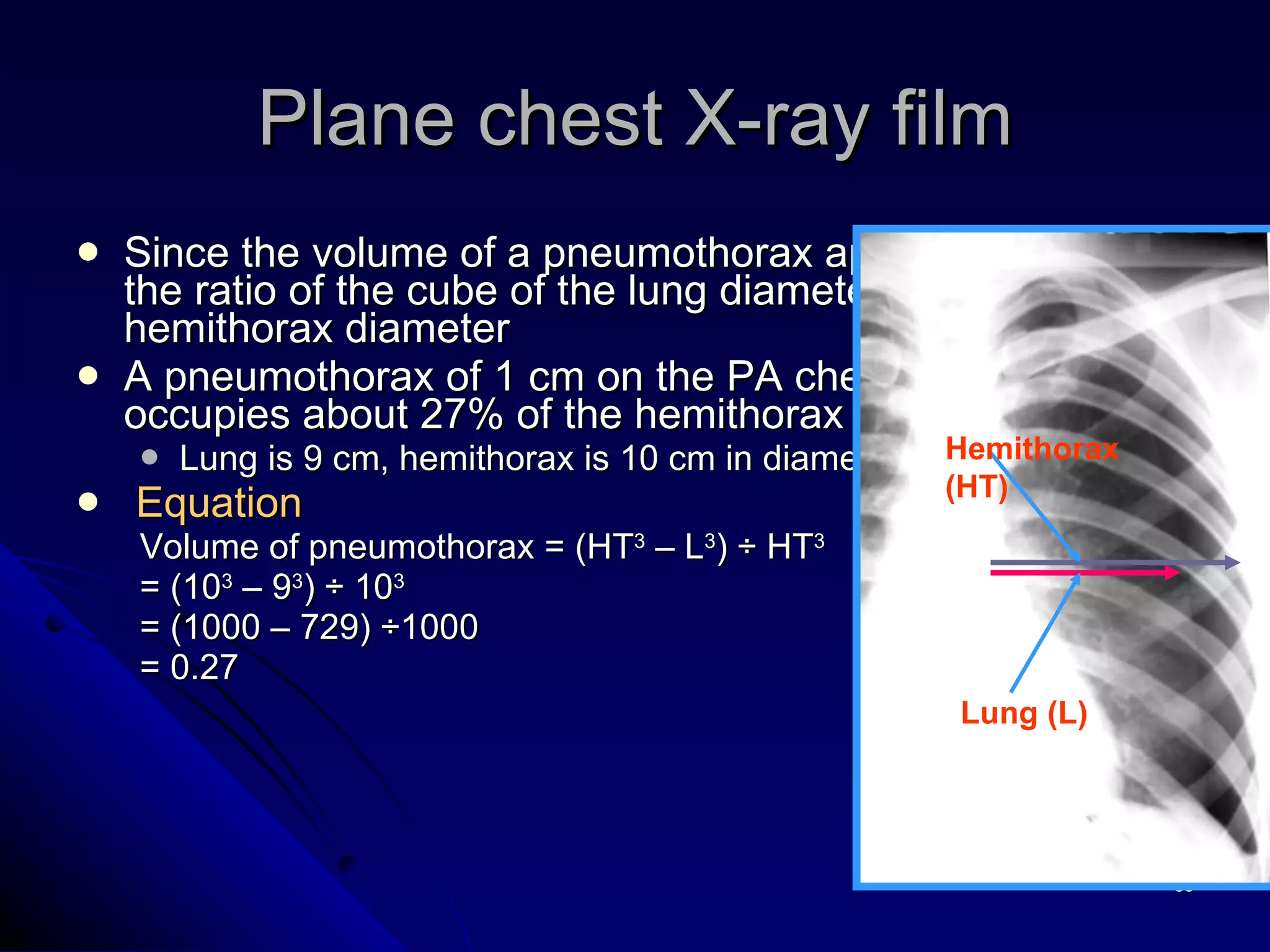 Since the volume of a pneumothorax approximates to the ratio of the cube of the lung diameter to the hemithorax diameter A pneumothorax of 1 cm on the PA chest radiograph occupies about 27% of the hemithorax volume Lung is 9 cm, hemithorax is 10 cm in diameter Equation  Volume of pneumothorax = (HT 3  – L 3 ) ÷ HT 3 = (10 3  – 9 3 ) ÷ 10 3   = (1000 – 729) ÷1000 = 0.27 Plane chest X-ray film Hemithorax (HT) Lung (L) 