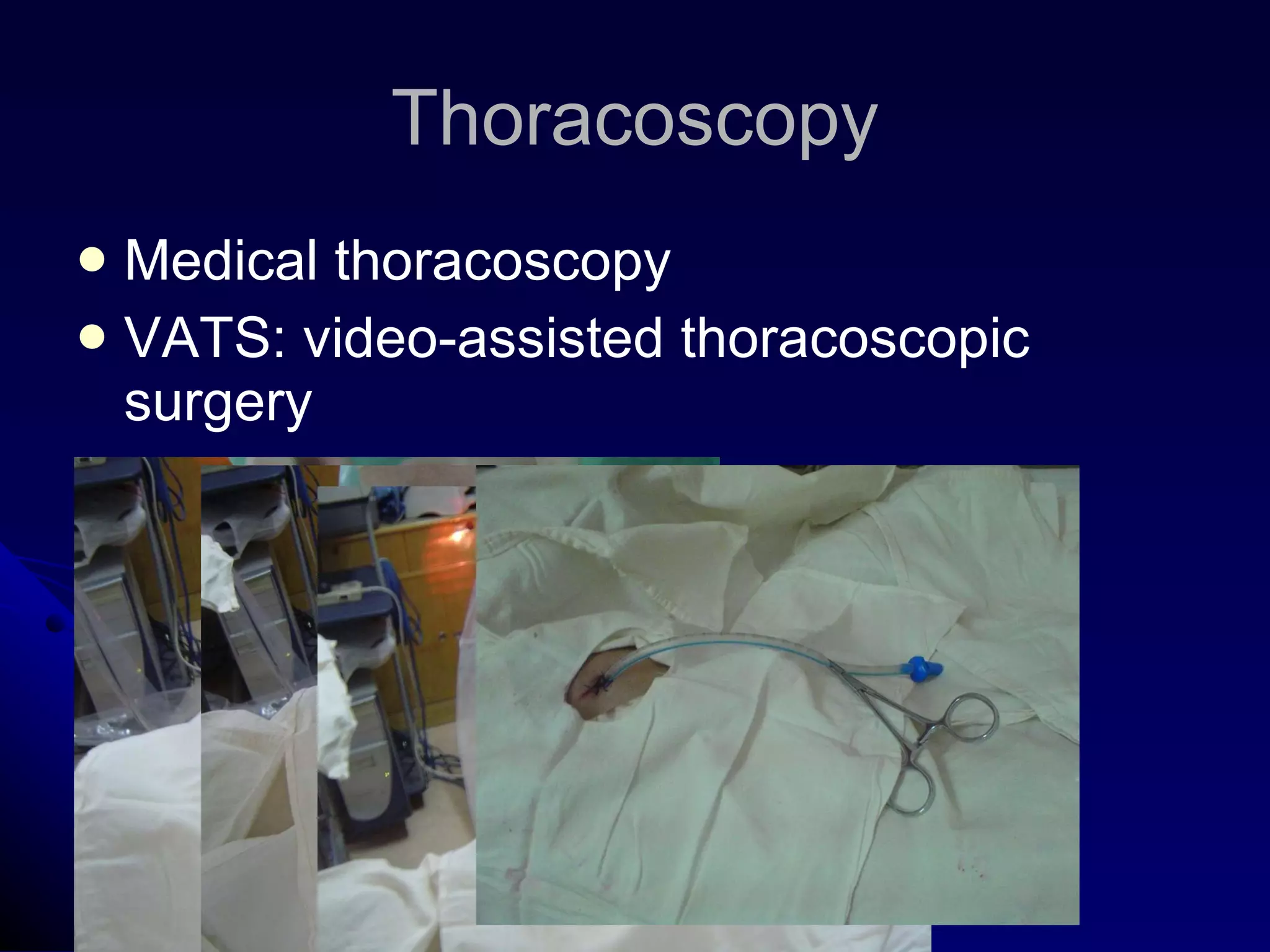Thoracoscopy Medical thoracoscopy VATS: video-assisted thoracoscopic surgery 