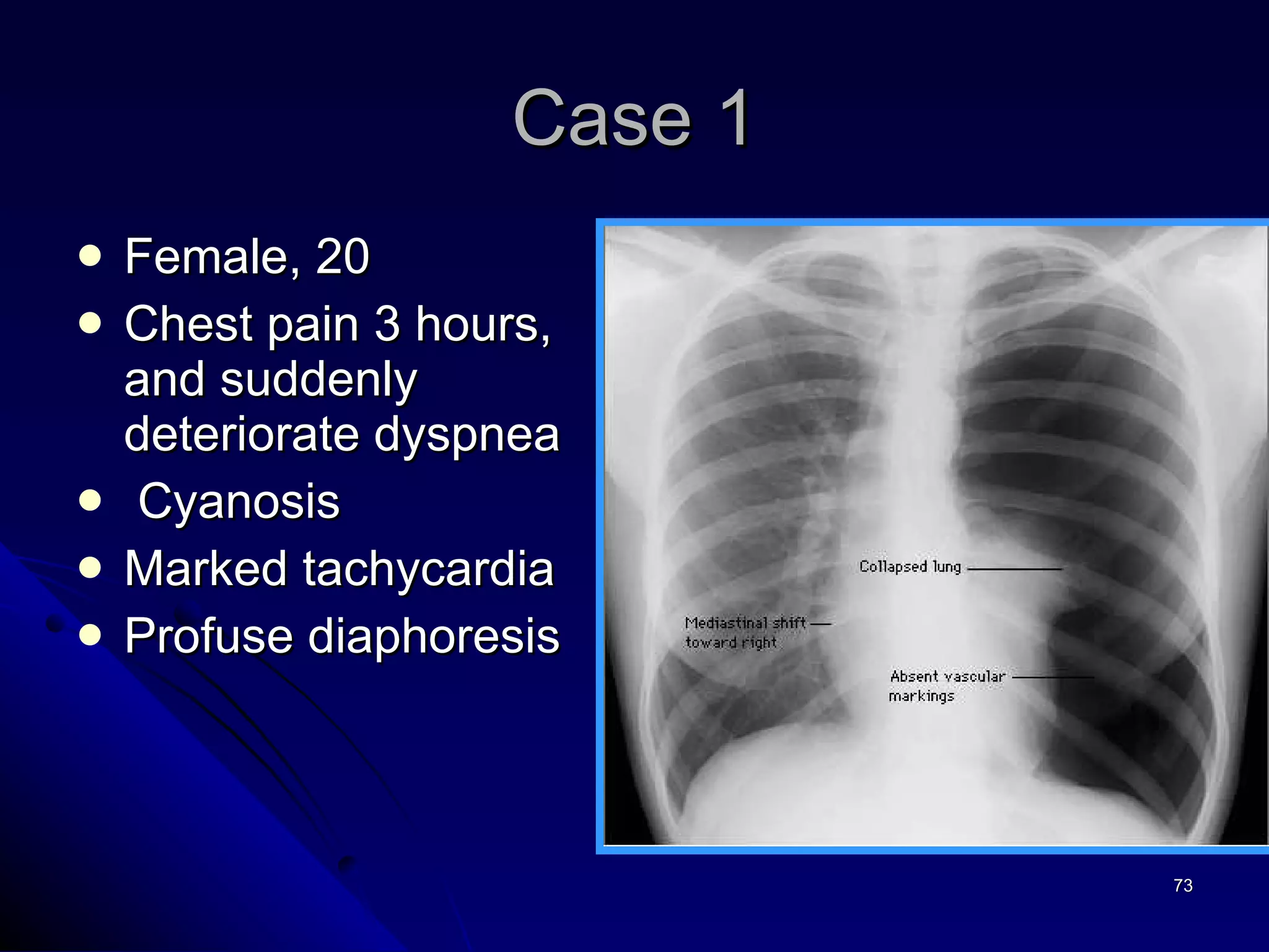 Case 1 Female, 20 Chest pain 3 hours, and suddenly deteriorate dyspnea Cyanosis Marked tachycardia  Profuse diaphoresis  
