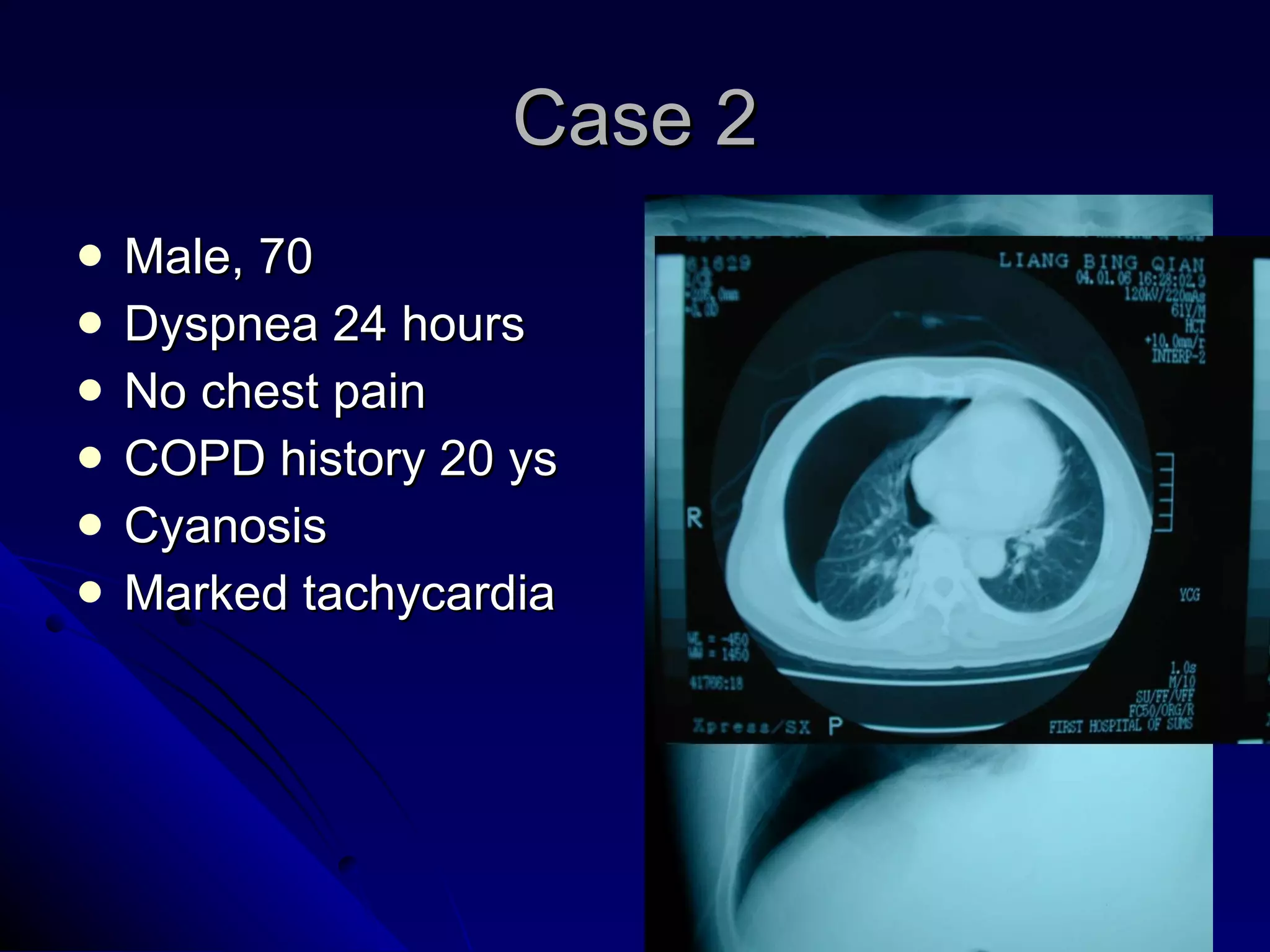 Case 2 Male, 70 Dyspnea 24 hours No chest pain COPD history 20 ys Cyanosis Marked tachycardia 