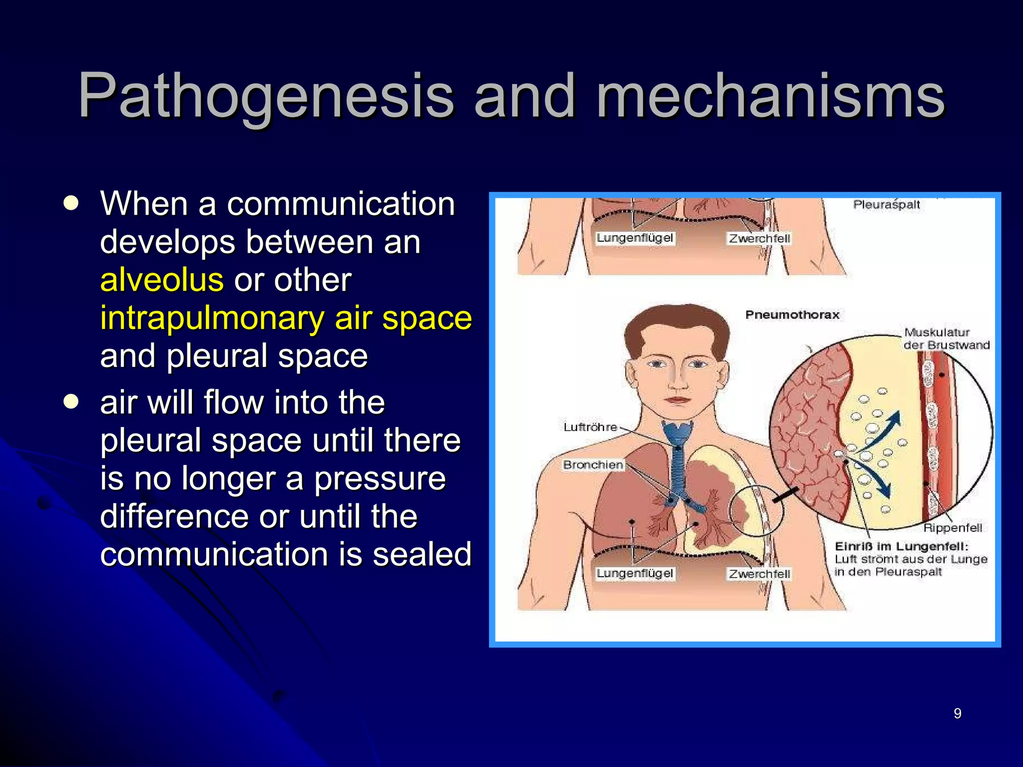 When a communication develops between an  alveolus  or other  intrapulmonary air space  and pleural space air will flow into the pleural space until there is no longer a pressure difference or until the communication is sealed Pathogenesis and mechanisms 