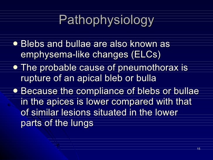 10.Pneumothorax