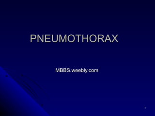 PNEUMOTHORAX MBBS.weebly.com 
