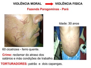 VIOLÊNCIA MORAL                 VIOLÊNCIA FISICA
                   Fazenda Paragominas - Pará



                                          Idade: 30 anos




60 cicatrizes - ferro quente.
Crime: reclamar do atraso dos
salários e más condições de trabalho.
TORTURADORES: patrão e dois capangas.
 