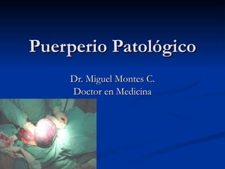 Puerperio Patológico Dr. Miguel Montes C. Doctor en Medicina 
