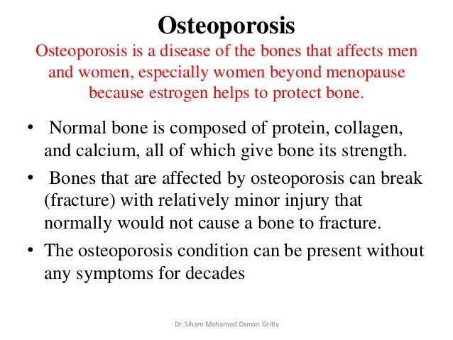 the skeletal system disease of osteoporosis The skeletal system helps us in the basic function of movement disorders of this system can range from the commonly occurring medical condition osteoporosis to the. the skeletal system disease of osteoporosis The skeletal system helps us in the basic function of movement disorders of this system can range from the commonly occurring medical condition osteoporosis to the.