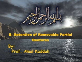 B- Retention of Removable Partial
Dentures
By:
Prof. Amal Kaddah
 