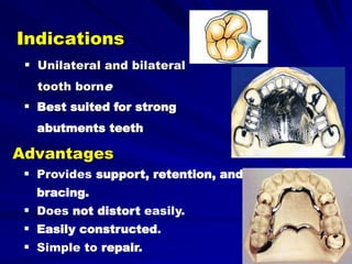 Unilaterl Rpds b- Retainers of RPDs | PPT