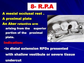 Ring Rest Rpd b- Retainers of RPDs | PPT