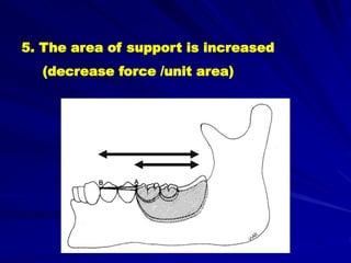 Support Stability Retention Rpd b- Retainers of RPDs | PPT
