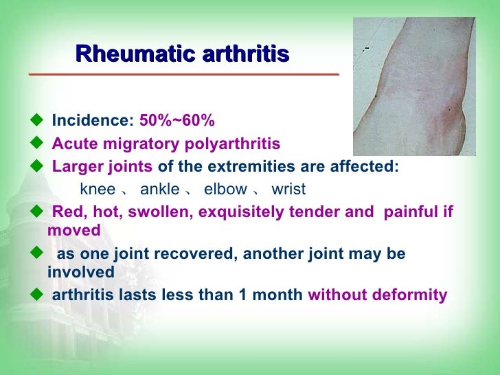 10 Rheumatic Fever