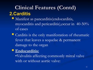 Comprehensive Overview of Acute Rheumatic Fever: Etiology, Clinical ...