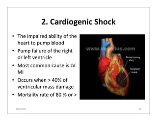 2. Cardiogenic Shock
• The impaired ability of the
heart to pump blood
• Pump failure of the right
or left ventricle
or left ventricle
• Most common cause is LV
MI
• Occurs when > 40% of
ventricular mass damage
• Mortality rate of 80 % or >
8/17/2015 17
 