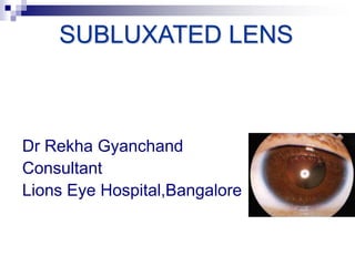 SUBLUXATED LENS
Dr Rekha Gyanchand
Consultant
Lions Eye Hospital,Bangalore
 