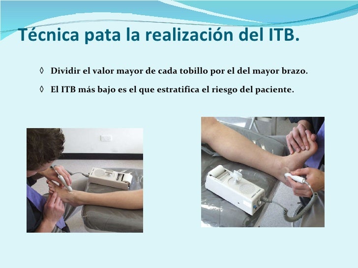 Taller de medición índice tobillo brazo
