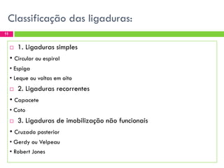 Classificação das ligaduras:
11



1. Ligaduras simples

• Circular ou espiral
• Espiga

• Leque ou voltas em oito


2. Ligaduras recorrentes

• Capacete
• Coto


3. Ligaduras de imobilização não funcionais

• Cruzado posterior
• Gerdy ou Velpeau
• Robert Jones

 