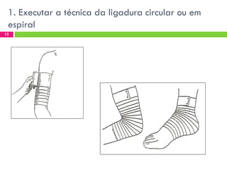 1. Executar a técnica da ligadura circular ou em
espiral
13

 