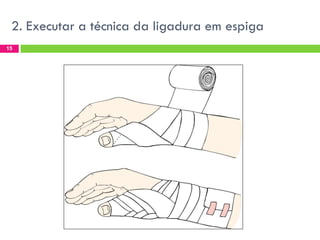 2. Executar a técnica da ligadura em espiga
15

 