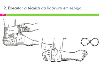 2. Executar a técnica da ligadura em espiga
17

 