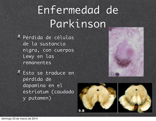 Enfermedad de
Parkinson
Pérdida de células
de la sustancia
nigra, con cuerpos
Lewy en las
remanentes
Esto se traduce en
pérdida de
dopamina en el
estriatum (caudado
y putamen)
domingo 23 de marzo de 2014
 