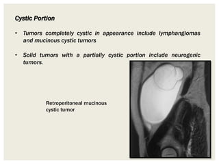 Cystic Portion
• Tumors completely cystic in appearance include lymphangiomas
and mucinous cystic tumors
• Solid tumors with a partially cystic portion include neurogenic
tumors.
Retroperitoneal mucinous
cystic tumor
 