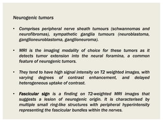 Neurogenic tumors
• Comprises peripheral nerve sheath tumours (schwannomas and
neurofibromas), sympathetic ganglia tumours (neuroblastoma,
ganglioneuroblastoma, ganglioneuroma).
• MRI is the imaging modality of choice for these tumors as it
detects tumor extension into the neural foramina, a common
feature of neurogenic tumors.
• They tend to have high signal intensity on T2 weighted images, with
varying degrees of contrast enhancement, and delayed
heterogeneous uptake of contrast.
• Fascicular sign is a finding on T2-weighted MRI images that
suggests a lesion of neurogenic origin. It is characterised by
multiple small ring-like structures with peripheral hyperintensity
representing the fascicular bundles within the nerves.
 